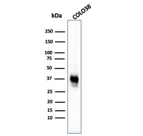 Western blot testing of human COLO-38 cell lysate with Melanoma Cell Marker antibody cocktail (clone