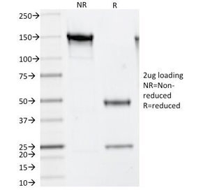 SDS-PAGE Analysis of Purified, BSA-Free Thymidylate Synthase Antibody (clone TS106). Confirmation of Integrity and Pur