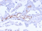 IHC staining of FFPE human uterus with von Willebrand Factor antibody cocktail. HIER: boil tissue sections in pH9 EDTA buffer, for 20 min and allow to cool before testing.