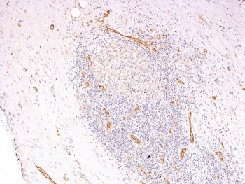 IHC: Formalin-fixed, paraffin-embedded human pancreas stained with vWF antibody cocktail (clones 3E2D10 + VWF635).~