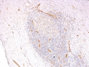 IHC: Formalin-fixed, paraffin-embedded human pancreas stained with vWF antibody cocktail (clones 3E2D10 + VWF635).