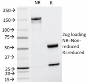 SDS-PAGE analysis of purified, BSA-free TRP1 antibody (clone TA99) as confirmation of integrity and purity.