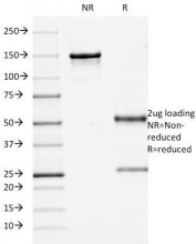 SDS-PAGE Analysis of Purified, BSA-Free CD68 Antibody (clone KP1). Confirmation of Integrity and Purity of the Antibody.