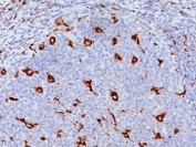 Formalin-fixed, paraffin-embedded human tonsil stained with CD68 antibody (clone KP1).