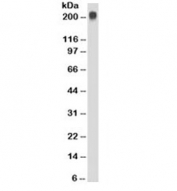 Western blot testing of Jurkat cell lysate with TAG-72 antibody (clone CC49). Expected molecular weight ~220kDa.