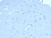 Negative control: IHC staining of FFPE human brain tissue with POMC antibody (clone 57). HIER: boil tissue sections in pH 9 10mM Tris with 1mM EDTA for 20 min and allow to cool before testing.