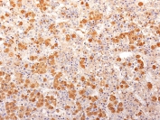 IHC: Formalin-fixed, paraffin-embedded human pituitary gland stained with ACTH / POMC antibody (clone 57). Required HIER: boil tissue sections in 10mM Citrate Buffer, pH 6.0, for 10-20 min followed by cooling at RT for 20 minutes.