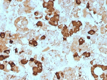 IHC staining of FFPE human pituitary gland with POMC antibody (clone 57). HIER: boil tissue sections in pH 9 10mM Tris with 1mM EDTA for 20 min and allow to cool before testing.~