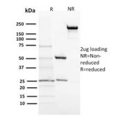 SDS-PAGE Analysis of Purified, BSA-Free POMC Antibody (clone 57). Confirmation of Integrity and Purity of the Antibody.