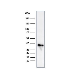 Western blot testing of human Raji cell lysate with CLIP antibody (clone CLIP/813). Expected molecular weight: 33-43 kDa.~