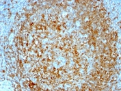 IHC analysis of formalin/paraffin human tonsil with CLIP antibody (clone CLIP/813).