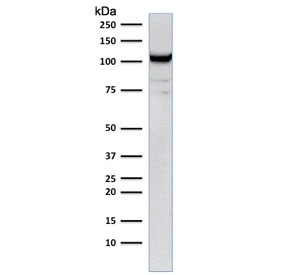 Western blot testing of human Jurkat cell lysate with CD31 antibody (clone C31.1). Expected molecular weight: 83-130 kDa depending on level of glycosylation.~