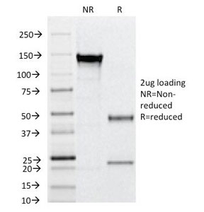 SDS-PAGE analysis of purified, BSA-free CD31 antibody (clone C31.12) as confir
