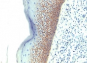 Formalin-fixed, paraffin-embedded human skin stained with E-Cadherin antibody (CDH1/1525).