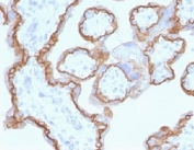 Formalin-fixed, paraffin-embedded human placenta stained with E-Cadherin antibody (CDH1/1525).