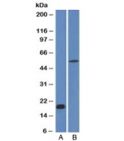 Western blot analysis A) partial recombinant protein B) human stomach lysate using E-Cadherin antibody (CDH1/1525). Expected molecular weight: 135 kDa (precursor), 80-120 kDa (mature, depending on gylcosylation level).
