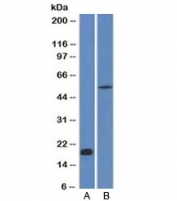 Western blot analysis A) partial recombinant protein B) human stomach lysate using E-Cadherin antibody (CDH1/1525). Expected molecular weight: 135 kDa (precursor), 80-120 kDa (mature, depending on glycosylation level).