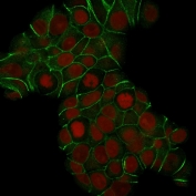 Immunofluorescent staining of human MCF7 cells with E-Cadherin antibody (clone CDH1/1525, green) and Reddot nuclear stain (red).