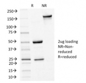 SDS-PAGE analysis of purified, BSA-free E-Cadherin antibody (clone CDH1/1525) as confirmation of integrity and purity.