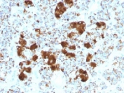 IHC testing of FFPE human pituitary gland with ACTH antibody (clone SPM501). Required HIER: steam sections in pH 9 10mM Tris with 1mM EDTA for 10-20 min.