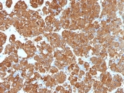 IHC testing of FFPE human pituitary gland with ACTH antibody (clone CLIP/1407). Required HIER: steam sections in EDTA buffer, pH9, for 10-20 min.