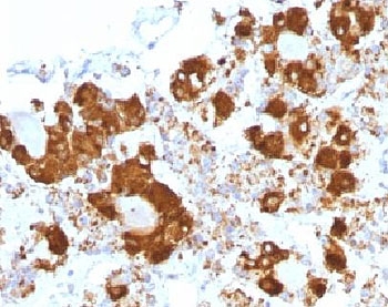 IHC testing of FFPE human pituitary gland with ACTH antibody (clone CLIP/1407). Required HIER: steam sections in 10mM citrate buffer, pH6, for 10-20 min.~