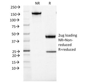 SDS-PAGE Analysis of Purified, BSA-Free ACTH Antibody (clone CLIP/1407). Confirmat
