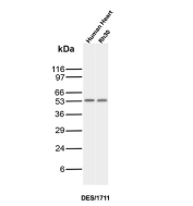 Desmin Antibody Human Heart and RH30 WB. Western blot analysis of human heart tissue and RH30 cell lysates using Desmin Antibody (clone DES/1711) detects a band at approximately 53 kDa, consistent with the expected molecular weight of Desmin, an intermediate filament protein expressed in muscle cells. The banding pattern supports detection of Desmin in muscle-derived tissue and rhabdomyosarcoma cells, aligning with its role as a structural cytoskeletal marker in muscle differentiation.
