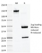 SDS-PAGE Analysis of Purified, BSA-Free Desmin Antibody (clone DES/1711). Confirmation of Integrity and Purity of the Antibody.