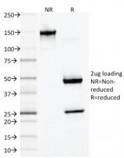 SDS-PAGE Analysis of Purified, BSA-Free Desmin Antibody (clone DES/1711). Confirmation of Integrity and Purity of the Antibody.
