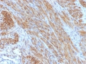 IHC testing of FFPE human uterus with Desmin antibody (clone DES/1711). Required HIER: boil tissue sections in 10mM citrate buffer, pH 6, for 10-20 min.
