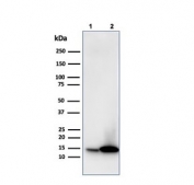 Western blot testing of human 1) JEG-3 and 2) K562 cell lysate with Galectin 1 antibody (clone GAL1/1831). Expected molecular weight ~14 kDa.