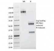 SDS-PAGE analysis of purified, BSA-free Galectin 1 antibody (clone GAL1/1831) as confirmation of integrity and purity.
