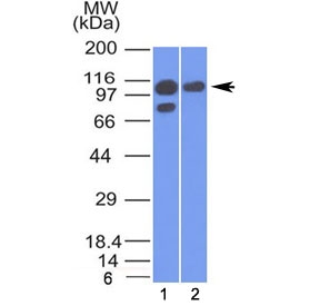 Western blot testing of human 1) A431 and 2) MCF7 cell lysate with Alpha Catenin antibody (clone 1G5). Expected molecular weight ~102 kDa.~