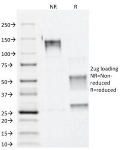 SDS-PAGE Analysis of Purified, BSA-Free Alpha Catenin Antibody (clone 1G5). Confirmation of Integ
