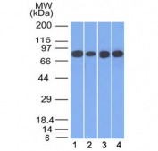 Western blot testing of human 1) HT20, 2) A549, 3) HEK293 and 4) A431 cell lysate with Plakoglobin antibody (clone 11E4). Predicted molecular weight: 80-87 kDa.