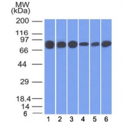 Western blot testing of human 1) HT20, 2) HEK293, 3) A431, 4) MCF7, 5) HEPG2 and 6) A549 cell lysate with Plakoglobin antibody (clone 15F11). Predicted molecular weight: 80-87 kDa.
