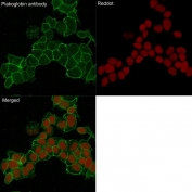 Immunofluorescent staining of human HeLa cells with Plakoglobin antibody (clone 15F11, green) and Reddot nuclear stain (red).