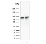 Western blot testing of human 1) HeLa and 2) SK-BR-3 cell lysate with Plakoglobin antibody (clone 15F11). Predicted molecular weight: 80-87 kDa.