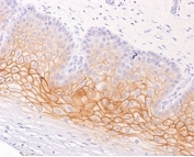 IHC staining of FFPE human cervix with Plakoglobin antibody (clone 15F11). HIER: boil tissue sections in pH 9 10mM Tris with 1mM EDTA for 20 min and allow to cool before testing.