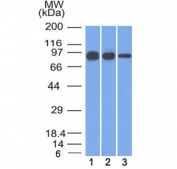 Western blot testing of human 1) A431, 2) A549 and 3) MCF7 cell lysate with Beta Catenin antibody (clone 12F7). Predicted molecular weight ~85 kDa, but routinely observed at 90-95 kDa.
