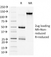 SDS-PAGE Analysis of Purified, BSA-Free b-Catenin Antibody (clone 9F2). Confirmation of Integrity and Purity of the Antibody.