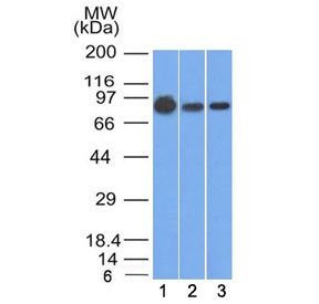 Western blot testing of human 1) A431, 2) A549 and 3) MCF7 cell lysate with Beta Catenin antibody (clone 9F2). Predicted molecular weight ~85 kDa, but routinely observed at 90-95 kDa.~