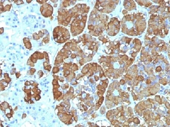 IHC testing of FFPE human pituitary gland with ACTH antibody (clone CLIP/1449). Required HIER: steam sections in 10mM citrate buffer, pH6, for 10-20 min.~