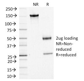 SDS-PAGE Analysis of Purified, BSA-Free ACTH Antibody (clone CLIP/1449). Confirmat