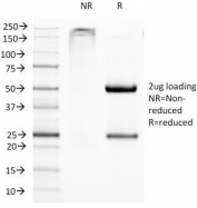 SDS-PAGE Analysis of Purified, BSA-Free CD11c Antibody (clone ITGAX/1284). Confirmation of Integrity and Purity of the Antibody.