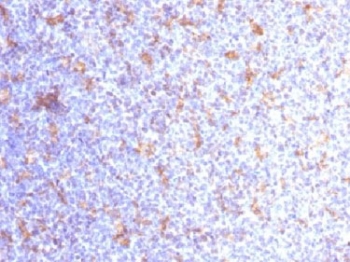 IHC testing of FFPE human tonsil with CD11c antibody (clone ITGAX/1284). Required HIER: boil tissue sections in 10mM Tris with 1mM EDTA, pH 9.0, for 10-20 min.~