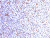 IHC testing of FFPE human tonsil with CD11c antibody (clone ITGAX/1284). Required HIER: boil tissue sections in 10mM Tris with 1mM EDTA, pH 9.0, for 10-20 min.