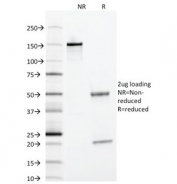 SDS-PAGE Analysis of Purified, BSA-Free Alpha 1 Antitrypsin Antibody (clone AAT/1378). Confirmation of Integrity and Purity of the Antibody.