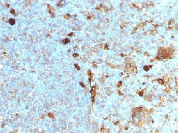 IHC testing of FFPE human tonsil with Alpha 1 Antitrypsin antibody (clone AAT/1378). Required HIER: steam sections in pH6, 10mM citrate buffer for 10-20 min.~